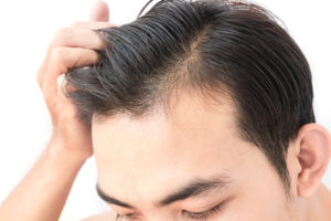 How much does a hair transplant cost