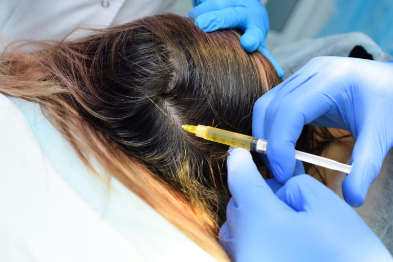 Hair restoration procedures