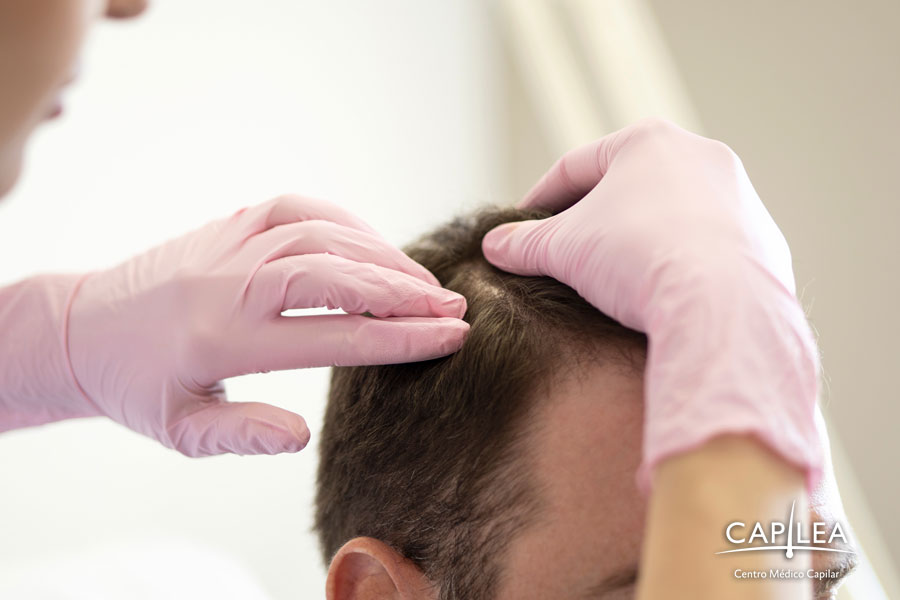 Hair transplant: Mexico is a country that has good hair transplant clinics.