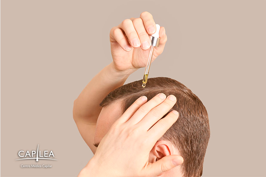 Minoxidil is being used to treat hair loss. 