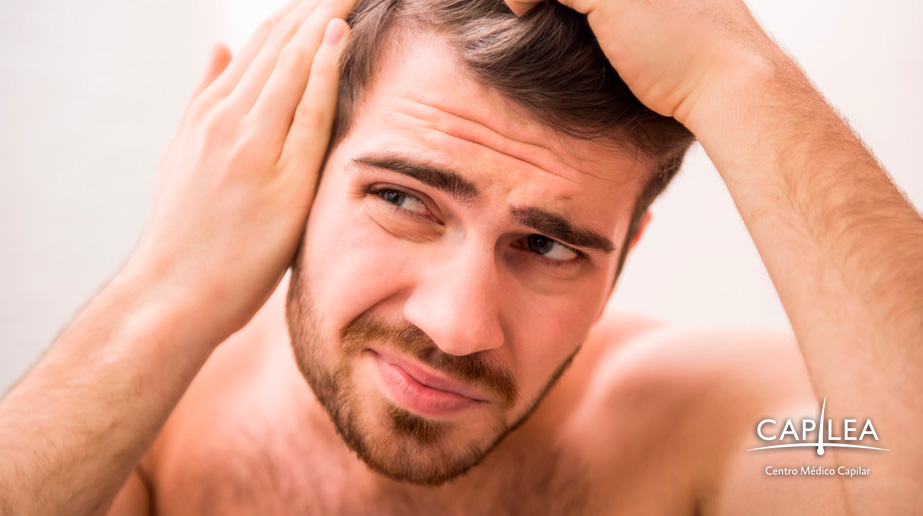 Hair loss causes stress and anxiety.