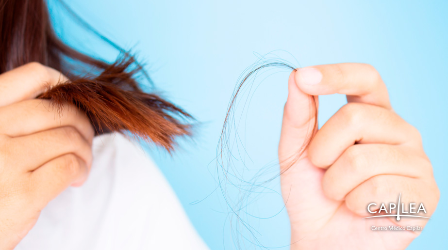 People can start to lose hair as early as adolescence.